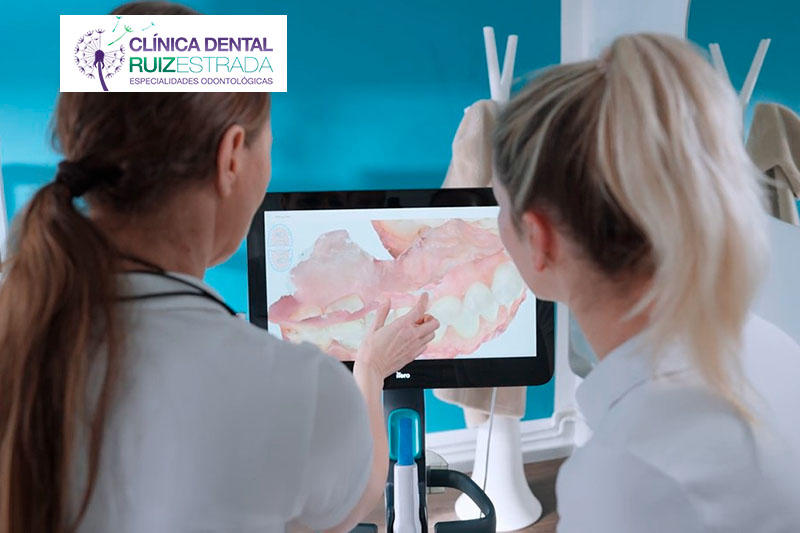 Escáner intraoral iTero: tecnología avanzada para tu salud bucodental